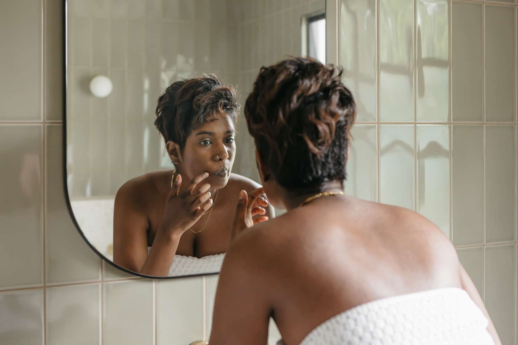 Acne Around The Mouth: Causes, Prevention, and Treatment