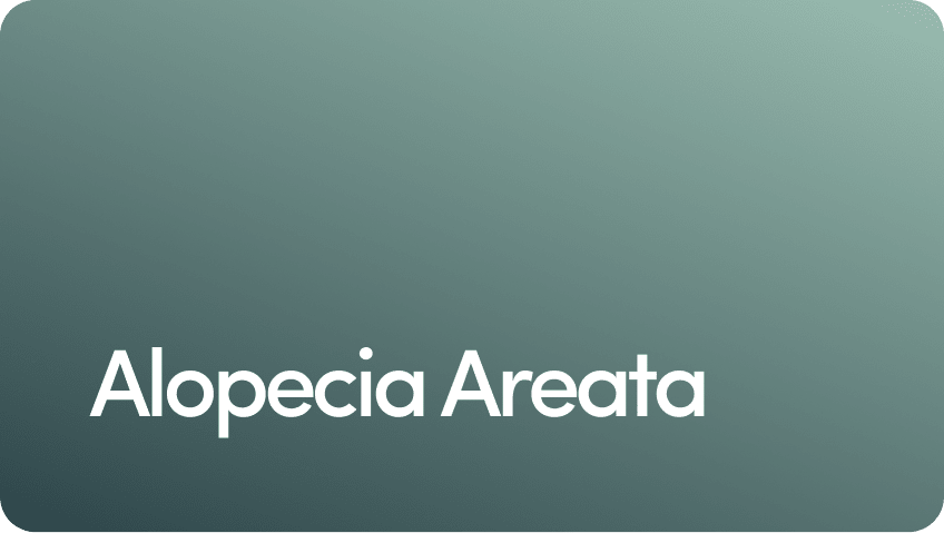 Alopecia Areata